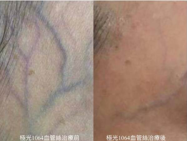 案例照片1