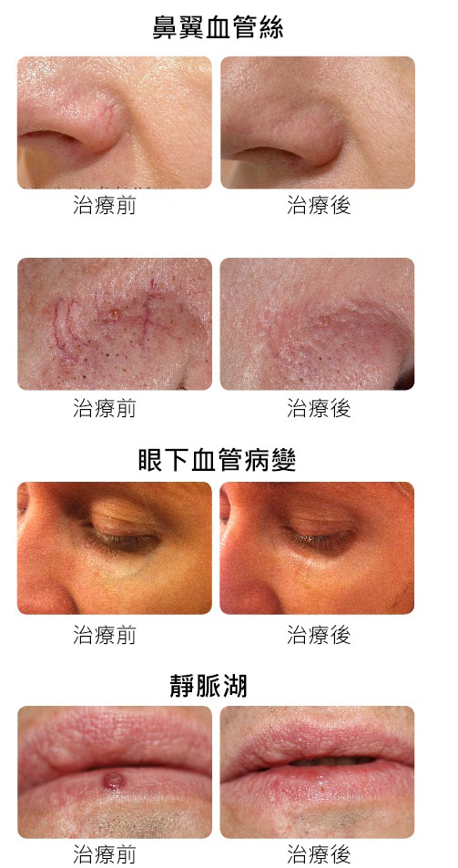 案例照片2