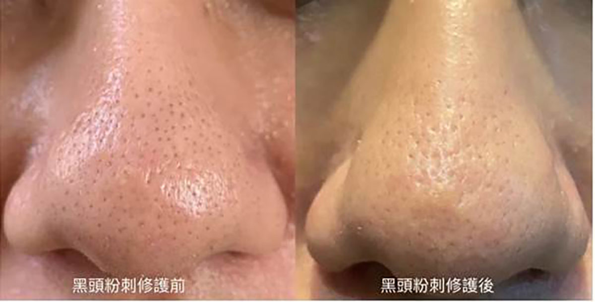 範例照片