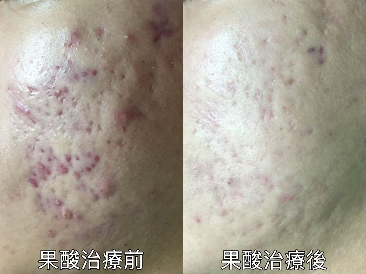 範例照片