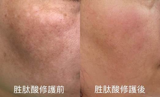 範例照片