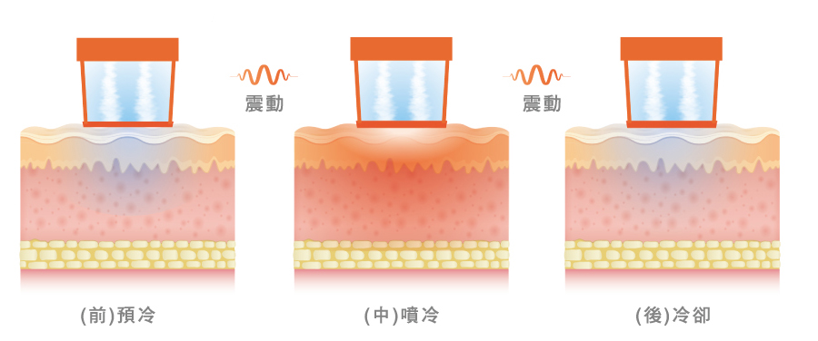 Oligio X超玩美電波可調式冷卻震動系統