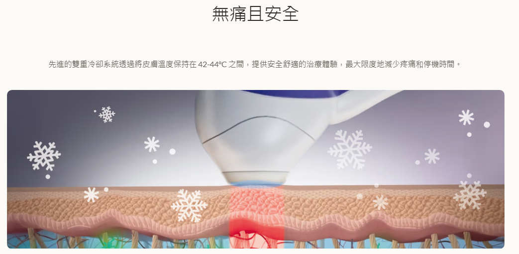Alma電波拉提效果圖