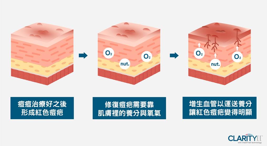 適應症